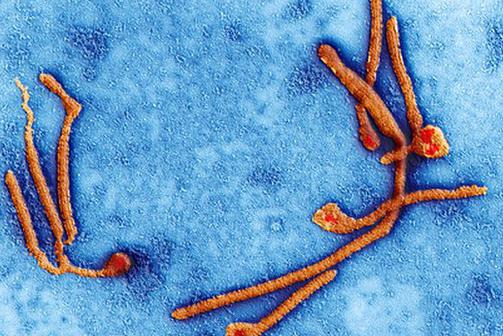 Hvad er Ebola? Ebola feber: årsager, symptomer, virkninger