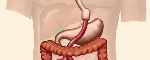 Gastrit og mavesår - årsager og symptomer på mavesygdom