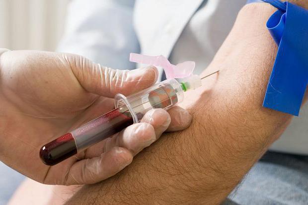 Lavt hæmoglobin hos mænd: Årsager, symptomer og karakteristika ved behandlingen