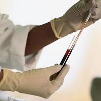 Normen af ​​blodprøven, hvad er dens betydning