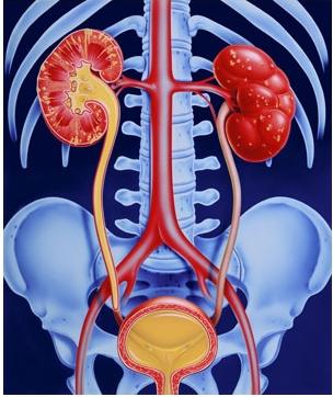 Pyelonefritis hvad er det